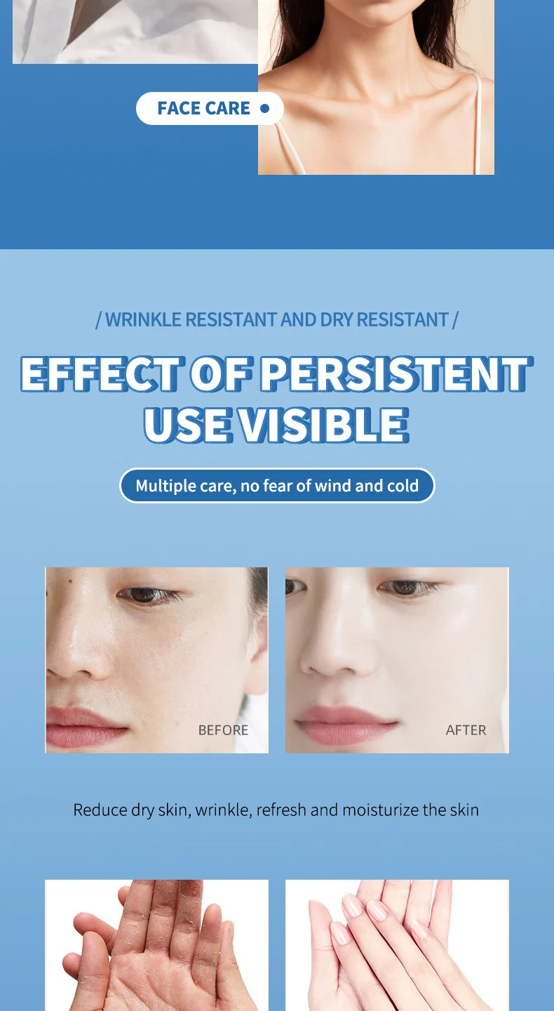 Anti-Crack Care Cream 40g Petroleum Jelly Hand Foot Moisturizer for Dry Cracked Skin 12 anti crack care cream petroleum jelly hand foot moisturizer 40g sit nc2qku8n desc 12