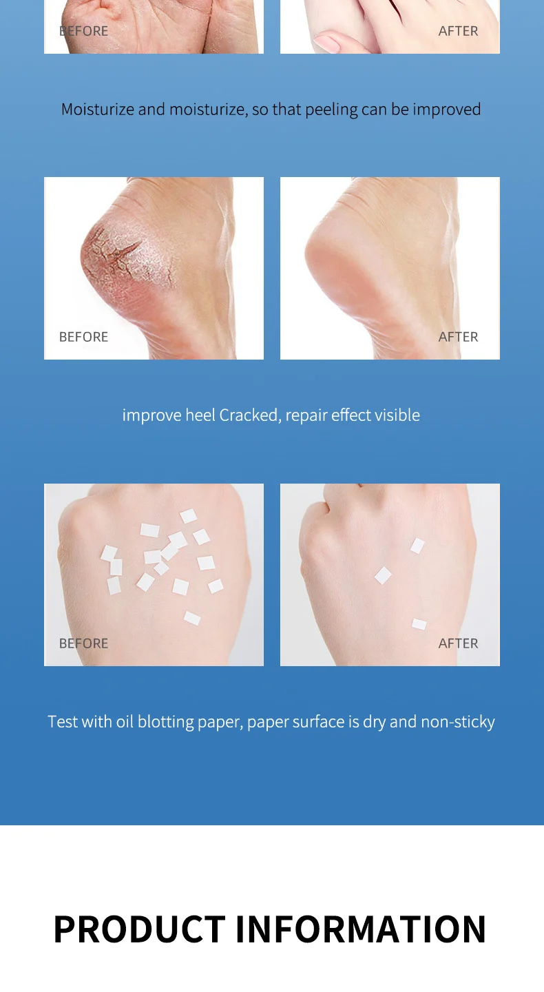 Anti-Crack Care Cream 40g Petroleum Jelly Hand Foot Moisturizer for Dry Cracked Skin 13 anti crack care cream petroleum jelly hand foot moisturizer 40g sit nc2qku8n desc 13