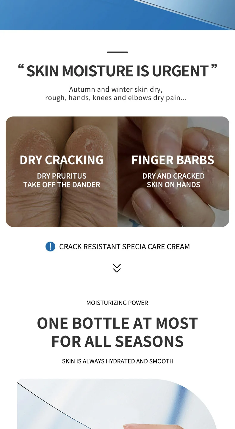 Anti-Crack Care Cream 40g Petroleum Jelly Hand Foot Moisturizer for Dry Cracked Skin 2 anti crack care cream petroleum jelly hand foot moisturizer 40g sit nc2qku8n desc 2
