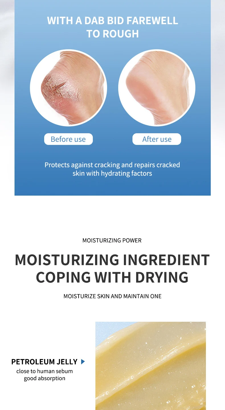 Anti-Crack Care Cream 40g Petroleum Jelly Hand Foot Moisturizer for Dry Cracked Skin 6 anti crack care cream petroleum jelly hand foot moisturizer 40g sit nc2qku8n desc 6