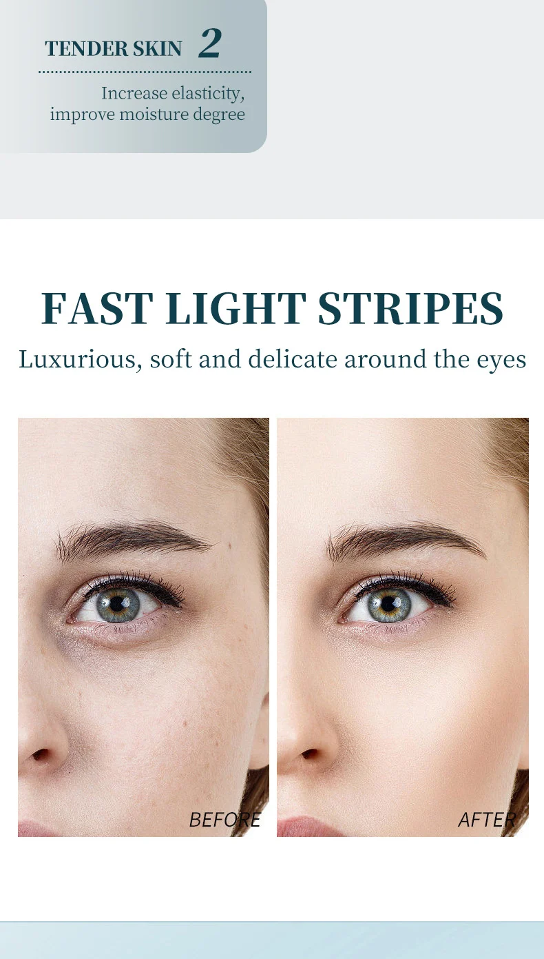 Massage Elastic Moist Eye Cream Anti-Wrinkle Brightening Hydrating Roller Ball 20g 10 massage elastic moist eye cream 20g sit m5emzsvh desc 10