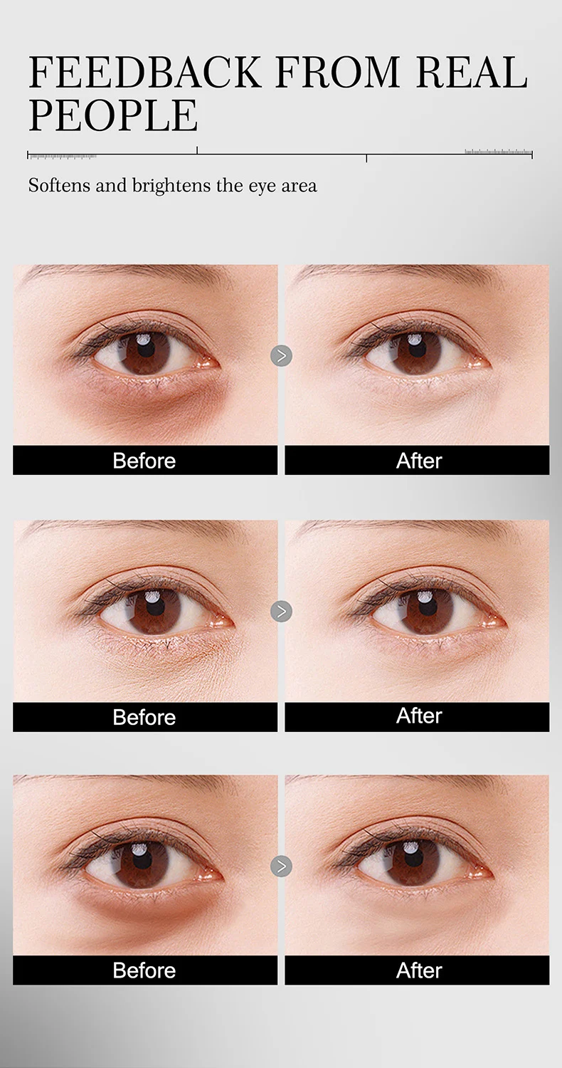 Moisturizing Eye Cream for Dark Circles and Wrinkles 6 moisten moisturizing eye cream sit 7t58pksq desc 6