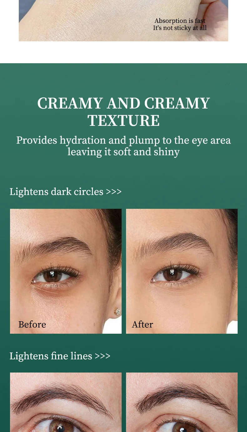 Retinol Eye Cream for Dark Circles and Wrinkles, Hydrating & Firming Anti-Aging Eye Treatment 30g 9 retinol eye cream dark circles wrinkles firming 30g sit 7byxczub desc 9