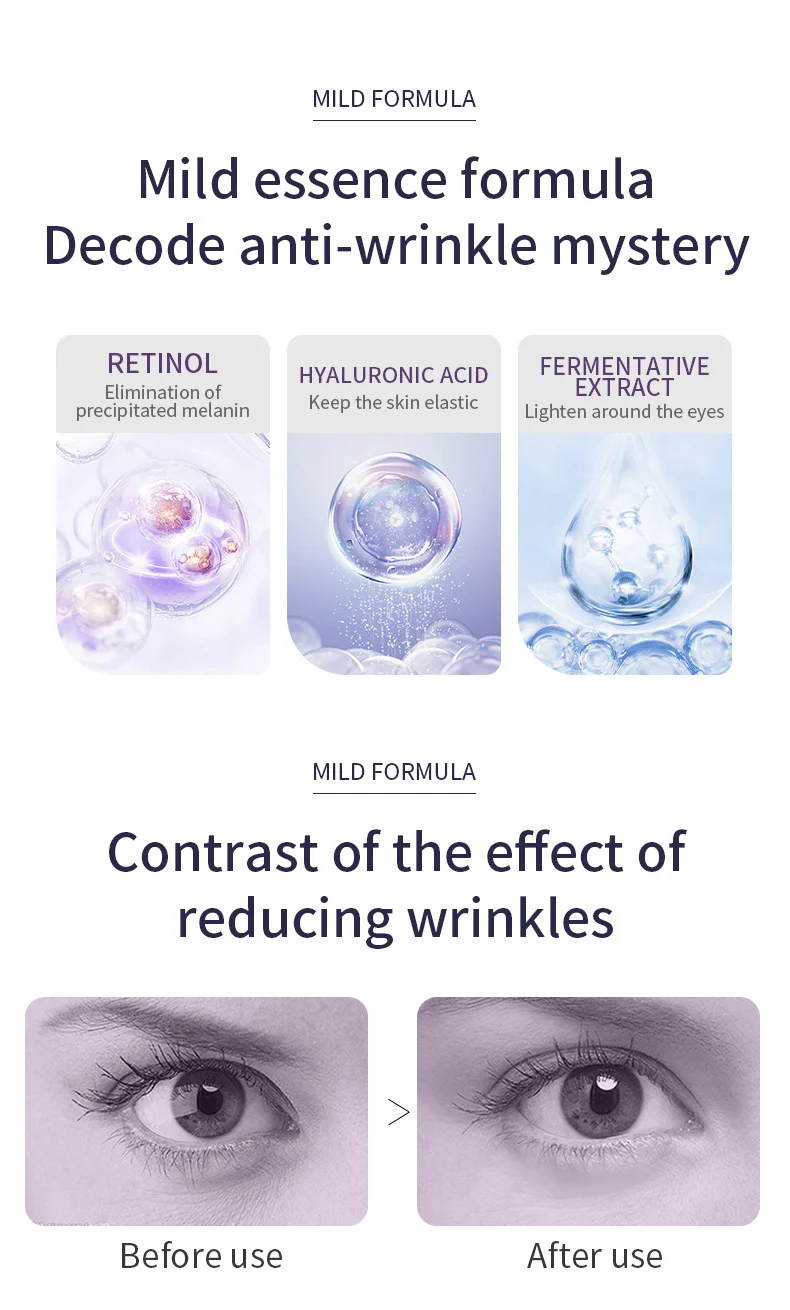 Roller Eye Cream for Anti-Wrinkle & Dark Circles with Cooling Massage Head 20g 11 roller eye cream anti wrinkle dark circles massage 20g sit qnqbmcsh desc 11