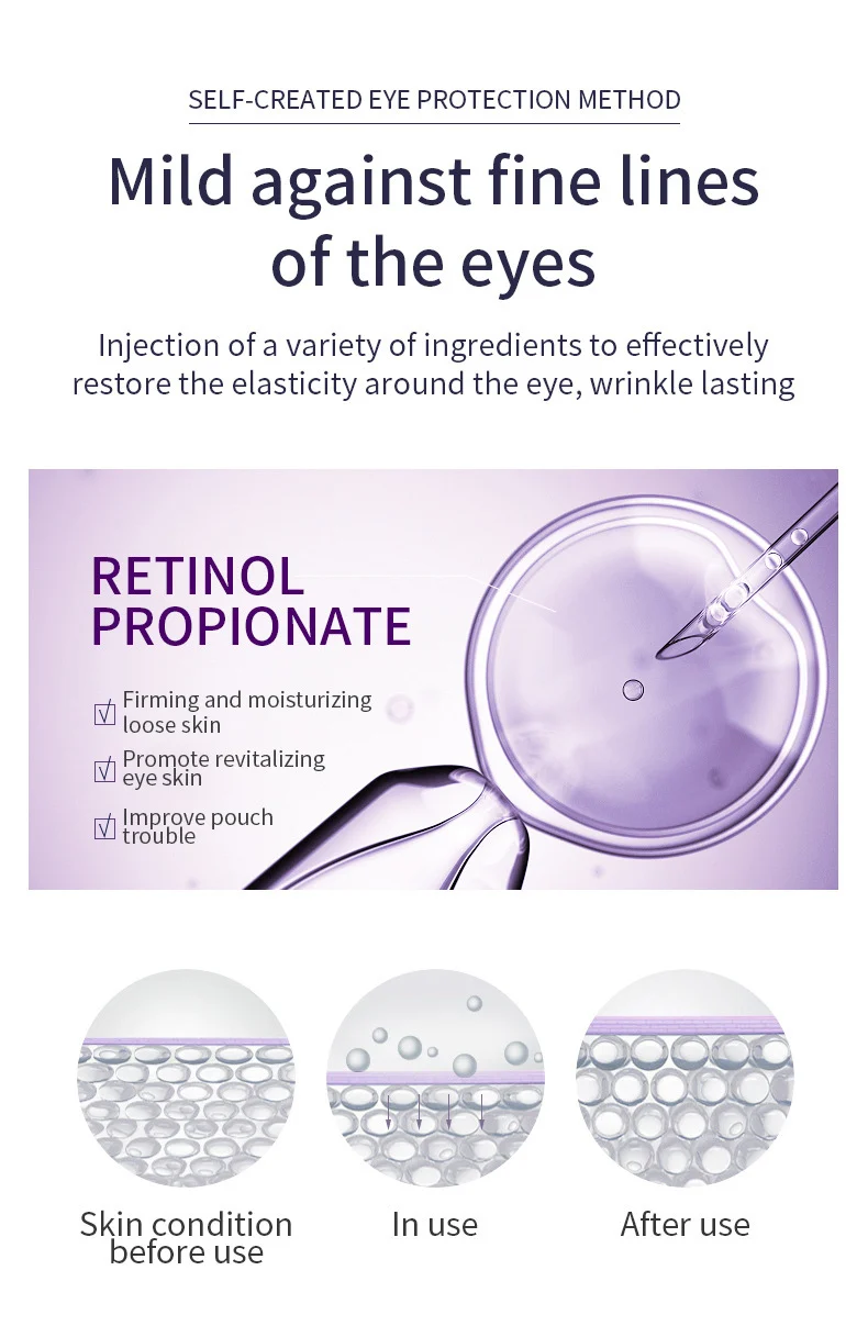 Roller Eye Cream for Anti-Wrinkle & Dark Circles with Cooling Massage Head 20g 6 roller eye cream anti wrinkle dark circles massage 20g sit qnqbmcsh desc 6