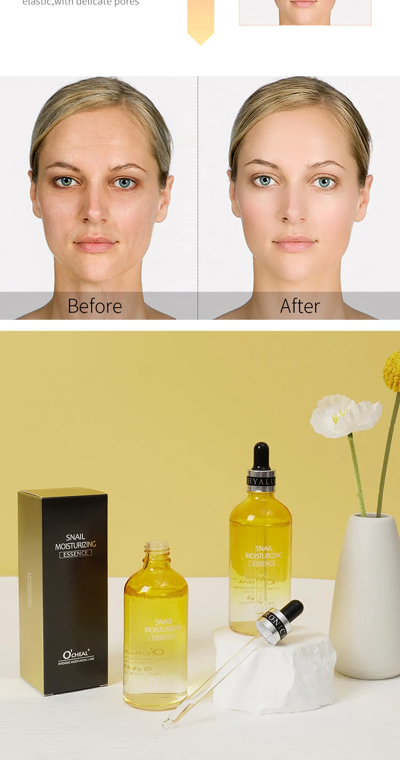 Snail Essence 100ml Hydrating Moisturizing Face Serum for Dryness & Fine Lines 6 snail moisturizing essence 100ml sit 75b6wa83 desc 6